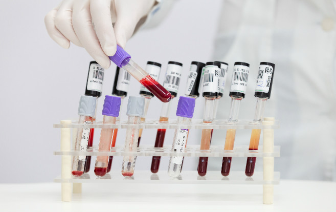 blood_test_tubes_lab_syringe_research